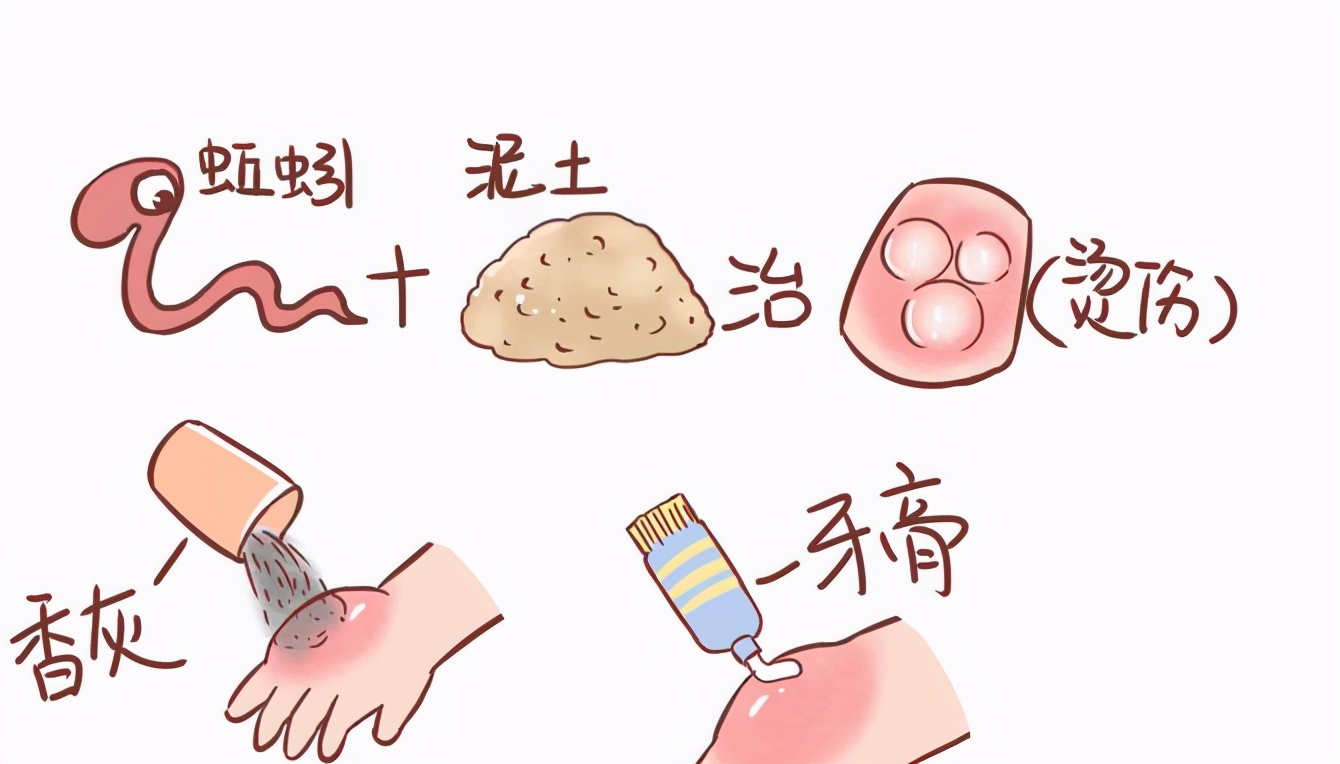 小孩被烫伤家人急救措施,孩子被烫伤家长应该怎么处理