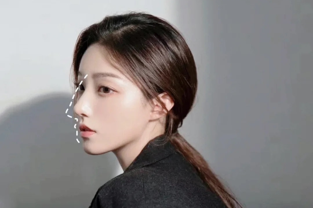 瘦鼻夹真的可以瘦鼻子吗,怎样瘦鼻子最快最有效的方法