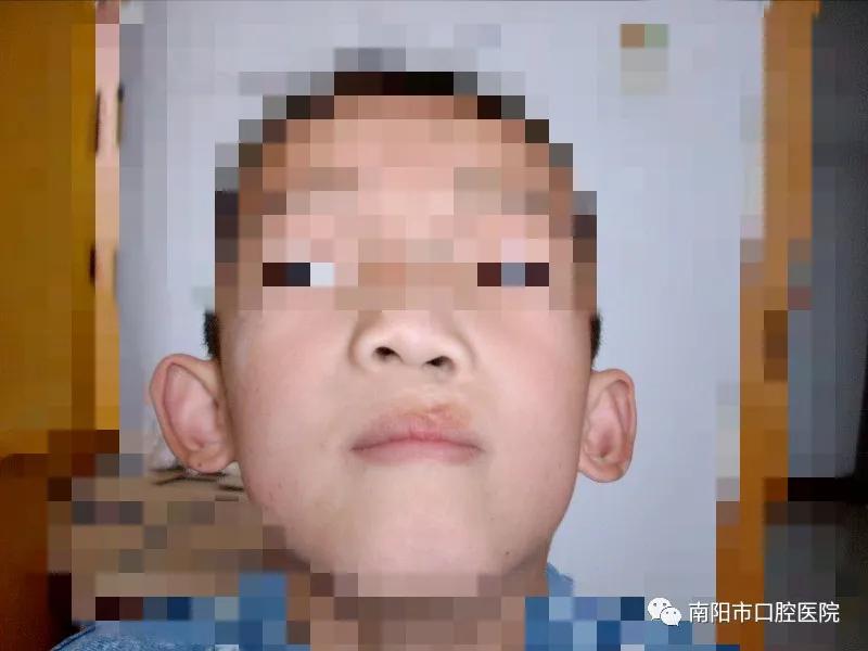 南阳口腔医院微笑列车,口腔医生温暖故事