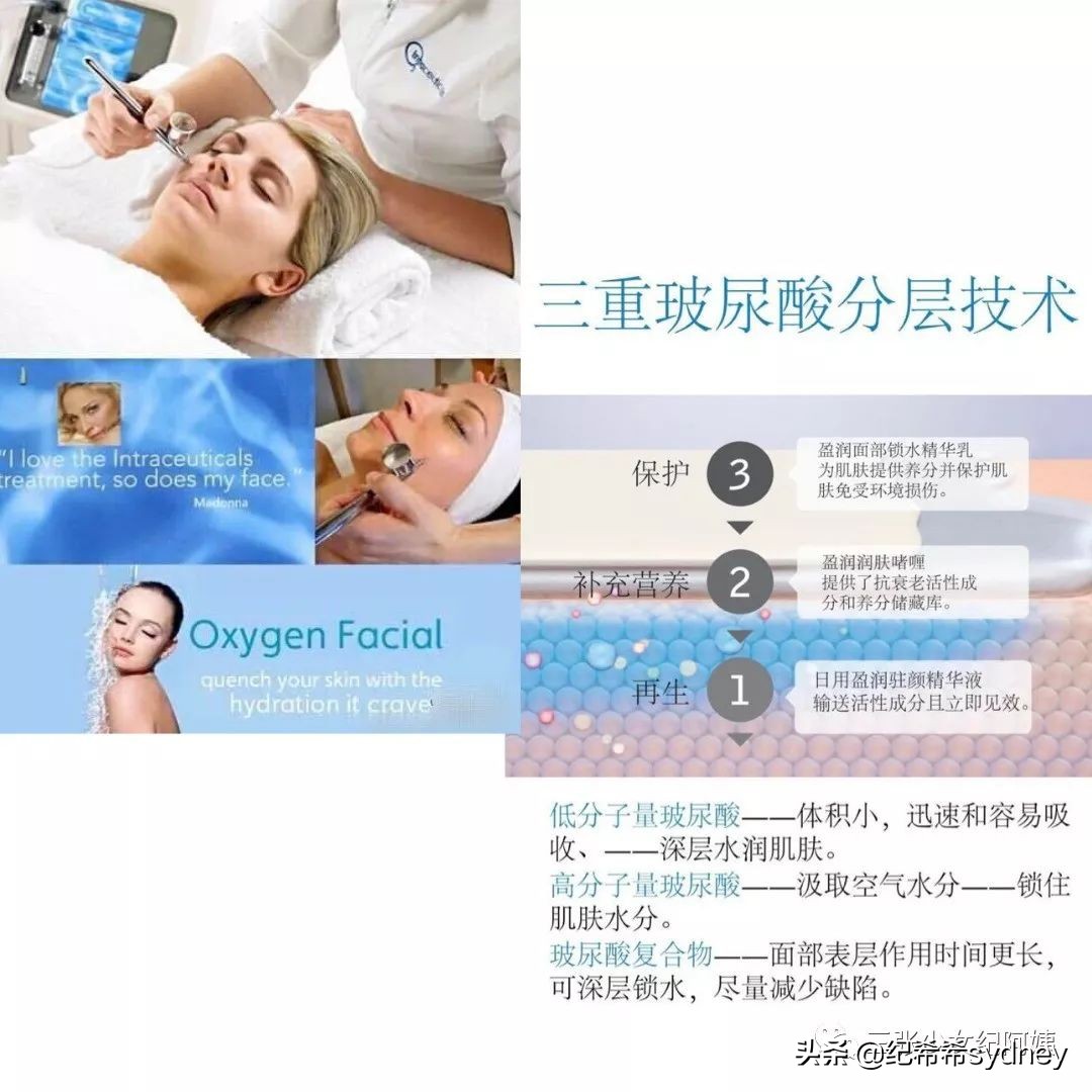 卡戴珊詹娜医美,卡戴珊太后医美