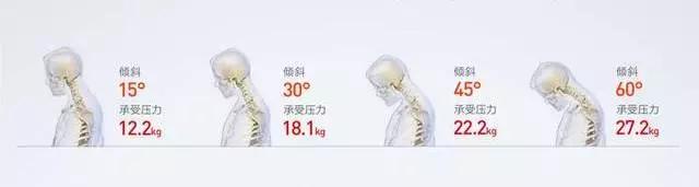 笔记本支架拯救颈椎,保护颈椎笔记本电脑支架