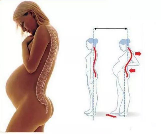 哪个说生娃儿就一定要痛？这些关于分娩镇痛的谣言太坑人！