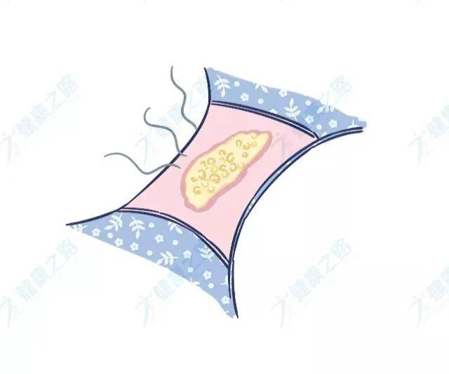 阴道有炎症白带多有什么症状,如果有炎症白带有什么变化