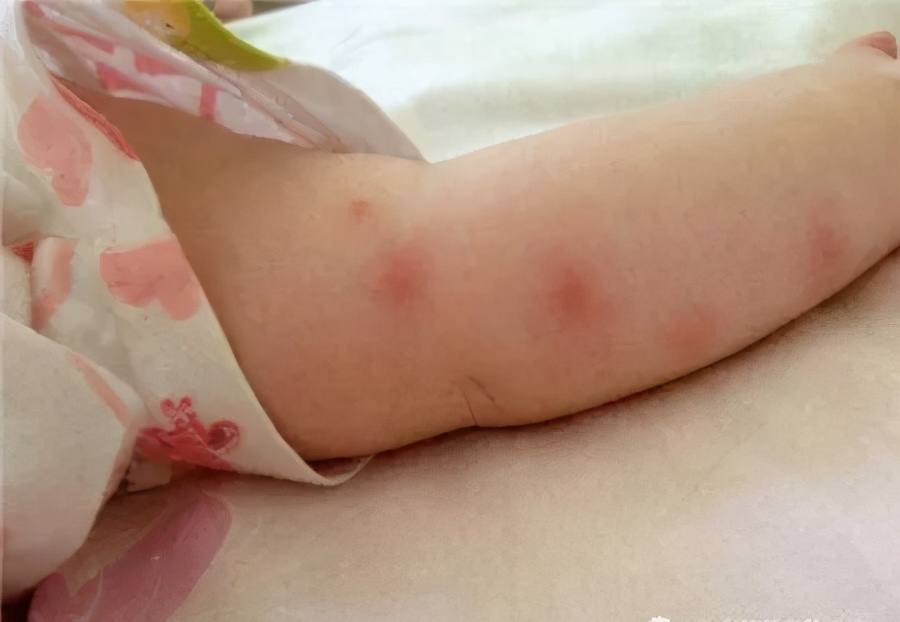 有效的驱蚊方法赶走蚊子,蚊子驱蚊小妙招