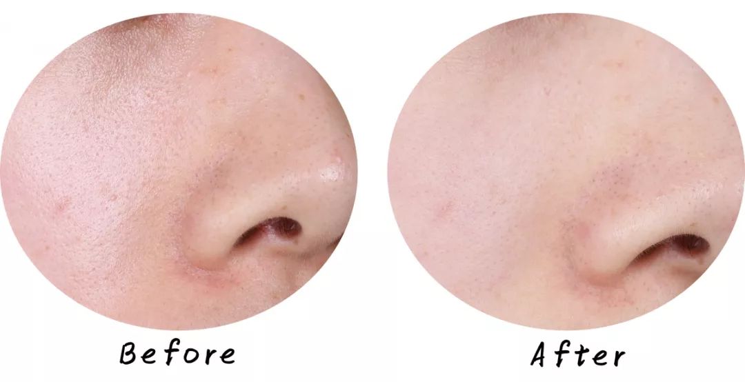 十大清洁面膜排行榜混合性皮肤,十大好用清洁面膜