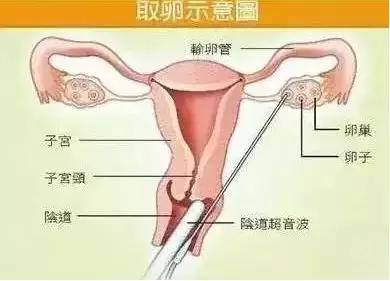 缃戜笂鎹愬嵉楠楀眬,鑺卞灏戝コ鎹愬嵉鍐呭箷