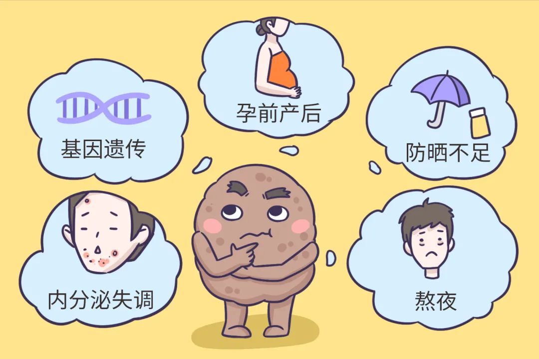 目前为止最温和无伤害的祛斑方法,揭秘有效祛斑方法大爆料