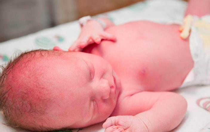 为什么宝宝出生后会有黄疸？什么情况需要住院？新生儿黄疸全解读