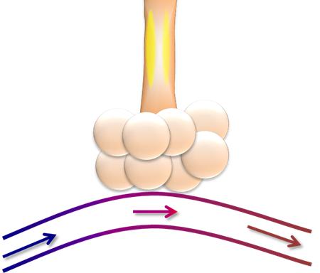 新冠肺炎机械通气系列课程(讲义)-阻塞性肺病的机械通气