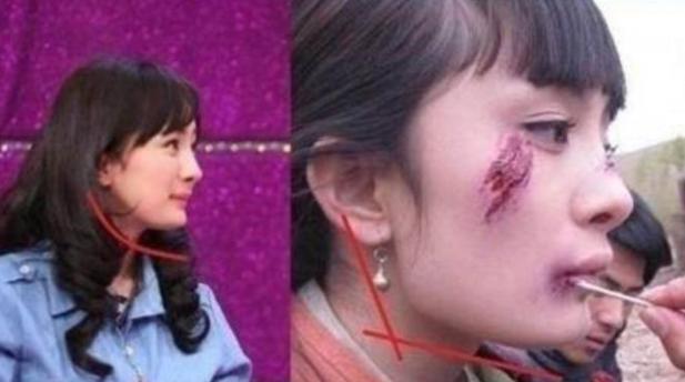 那些削骨的女明星怎么样了,哪些明星承认削骨了