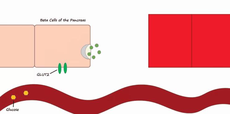 胰岛素是如何导致糖尿病的,胰岛素增多为什么会导致糖尿病
