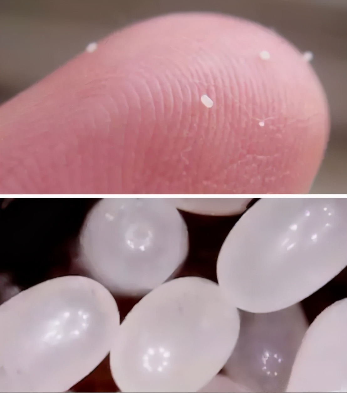 小小跳蚤全部小说,小小的跳蚤竟能养这么大