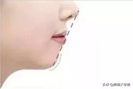 下巴后缩怎么拍侧颜,下巴后缩需要怎么矫正