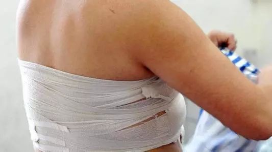 9岁小男孩吃炸鸡,男子吃炸鸡导致胸部发育