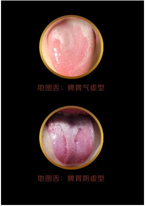 如何通过舌苔判断宝宝健康,中医教你从14种舌头的舌象看健康