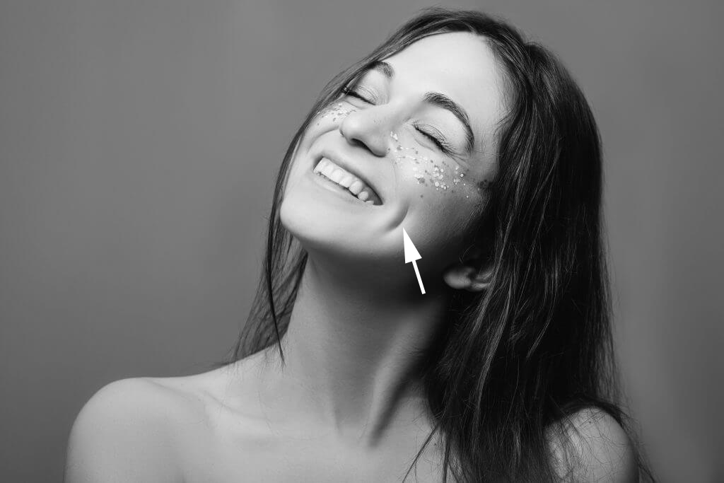 人造酒窝身体的缺陷,人造酒窝全过程