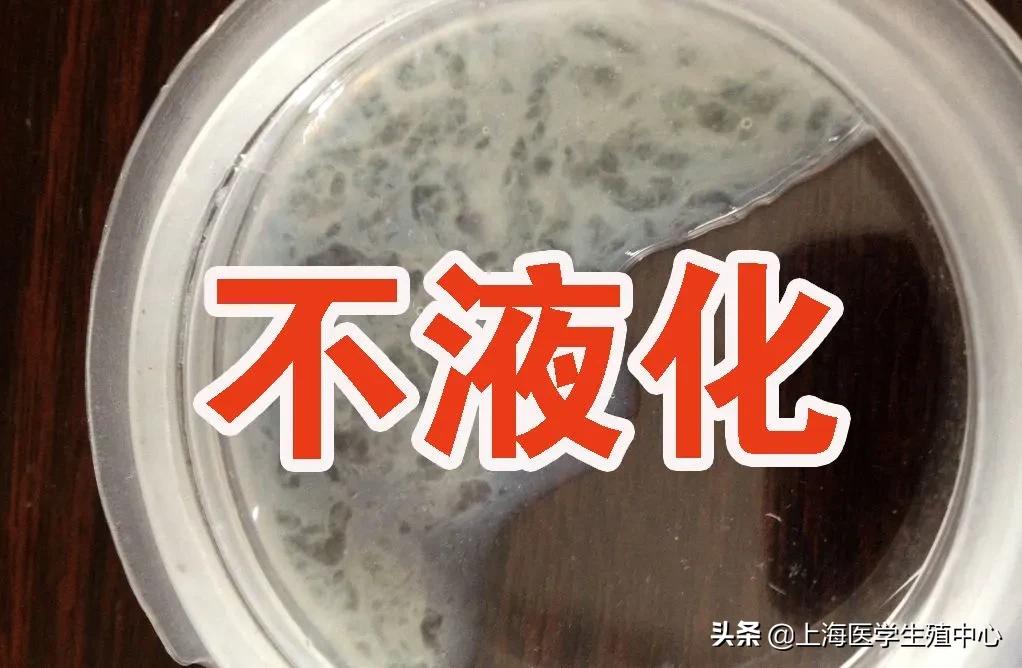 通过精子颜色可以看出精子质量吗,精子质量主要看哪几个指标