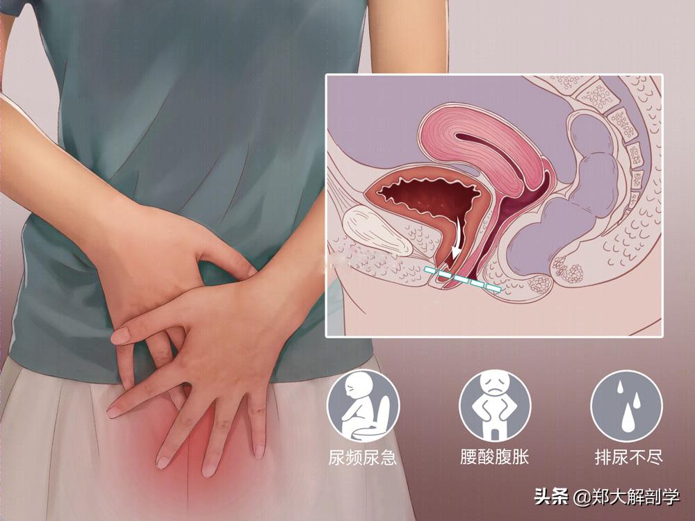 女性盆底功能障碍性疾病表现,南通治疗盆底功能障碍的医院