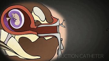 强奸犯不会嫌你孩子太小”“你嫌性教育太早，