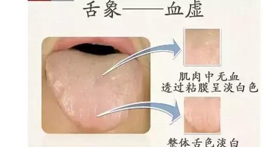 观舌识病22种舌诊图解大全,舌诊看舌头视频