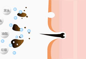 一招教你轻松去黑头,黑头去除小妙招明星