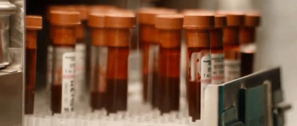 通过性传播艾滋病的条件,通过性传播的艾滋病人