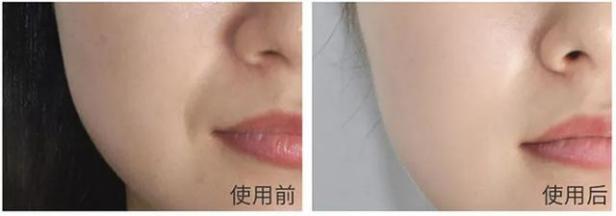 大长今宋慧乔金喜善,大长今金喜善宋慧乔