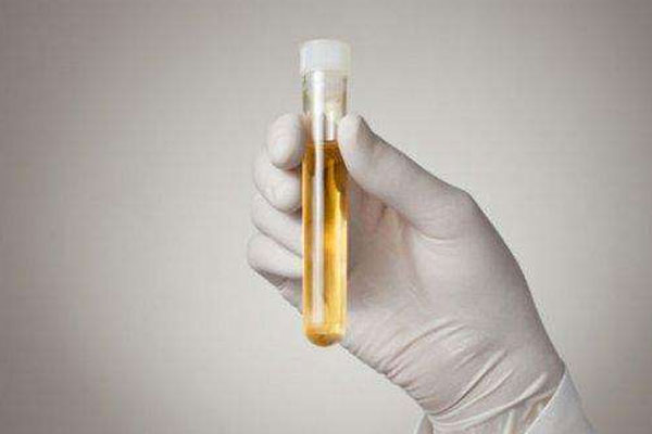 排尿时尿液呈白色是怎么回事,每天小便次数多少为正常