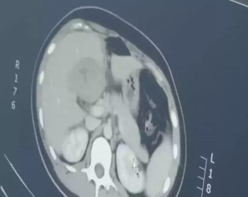 女生怀孕子宫为啥薄,女人怀孕的子宫