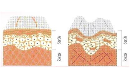 皮肤除皱纹方法,皮肤祛皱纹小妙招