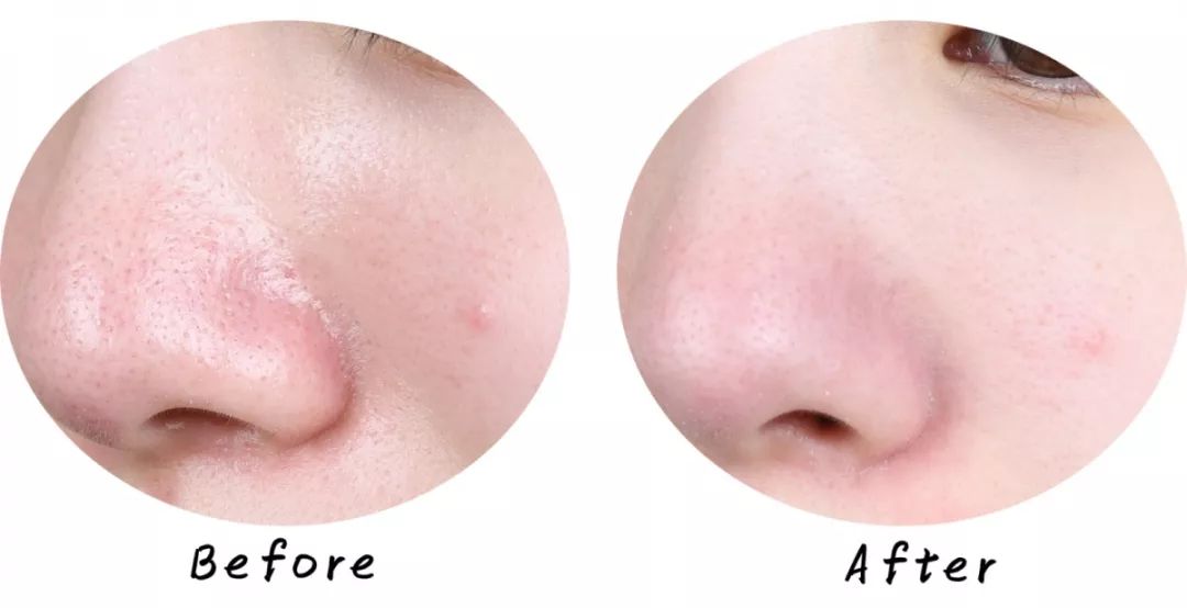 十大清洁面膜排行榜混合性皮肤,十大好用清洁面膜