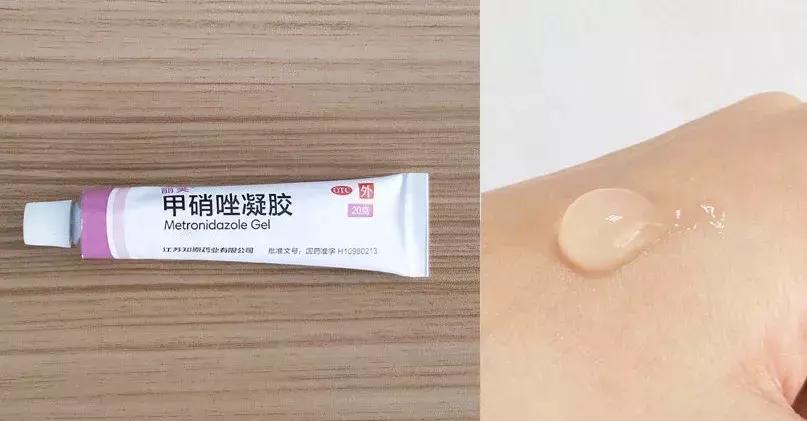 祛痘去黑头五次多少钱,祛痘100块钱