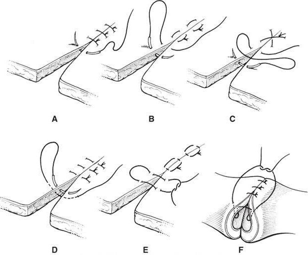 小磕小碰、摔伤烧伤在所难免，不想去医院，在家如何安全处理？