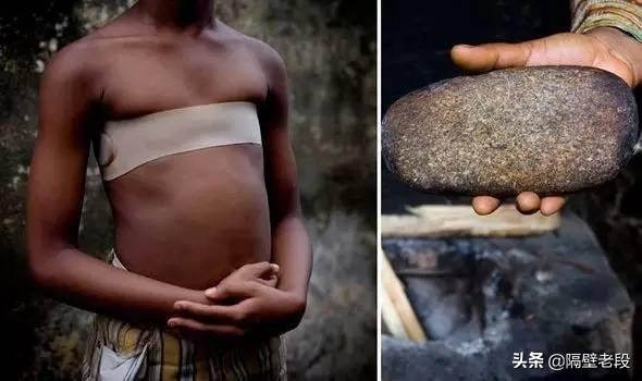 熨平少女胸部!揭秘非洲可怕习俗“烫乳”