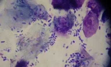 头皮屑多怎么办小妙招不需要钱,头皮屑多怎么办9个方法告别头屑