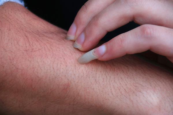 感染艾滋病身体有什么变化,感染了艾滋身上有哪些变化