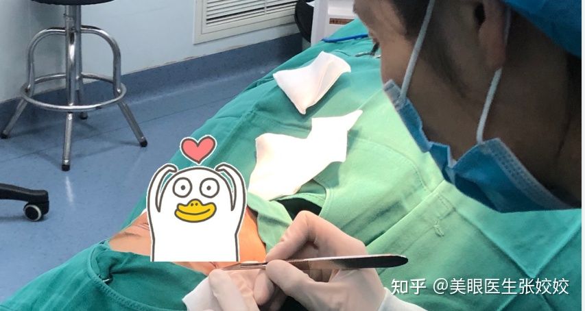 埋线双眼皮两边不对称怎么办,埋线双眼皮不对称修复方法