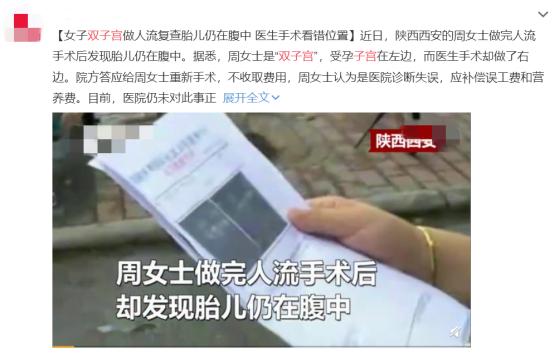 双子宫诞下双胞胎,滕州双子宫生下龙凤胎