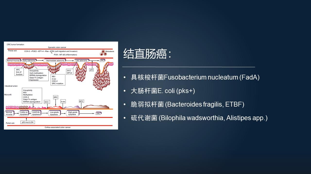 「图文实录」郑晓皎：18分钟详解菌群-胆汁酸与消化系统肿瘤