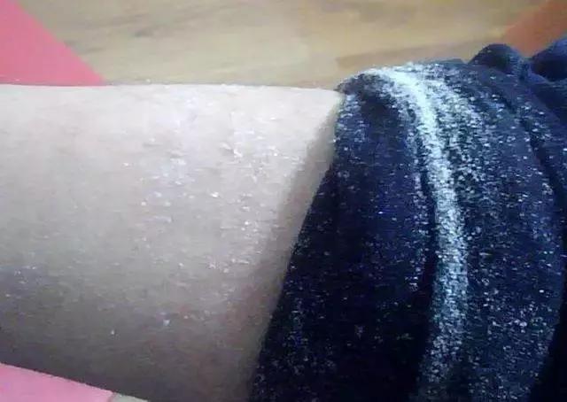 给干枯的身体洒水,给肌肤补充水分让皮肤放松