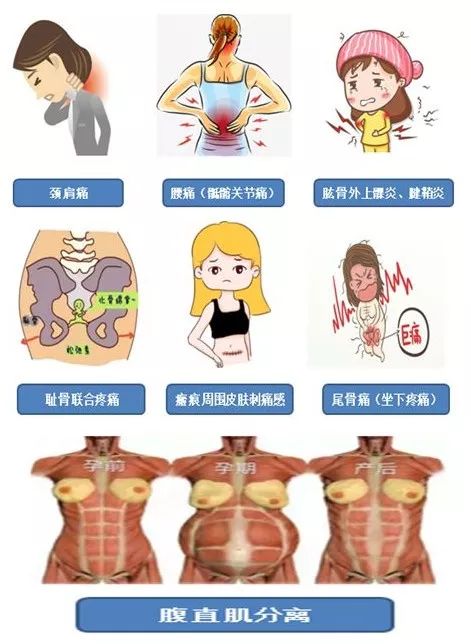 苏州阿姨30多年的难言之隐终解决，这个病许多妈妈有