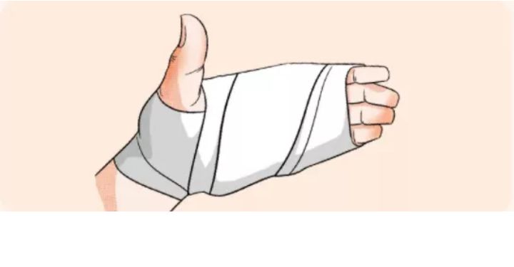 老人烫伤护理操作视频,老人在养老院被烫伤赔偿责任