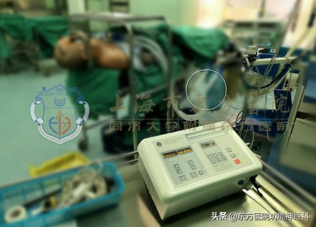 怎么才能让精神分裂症病人听话,早期发现精神分裂症怎么开导