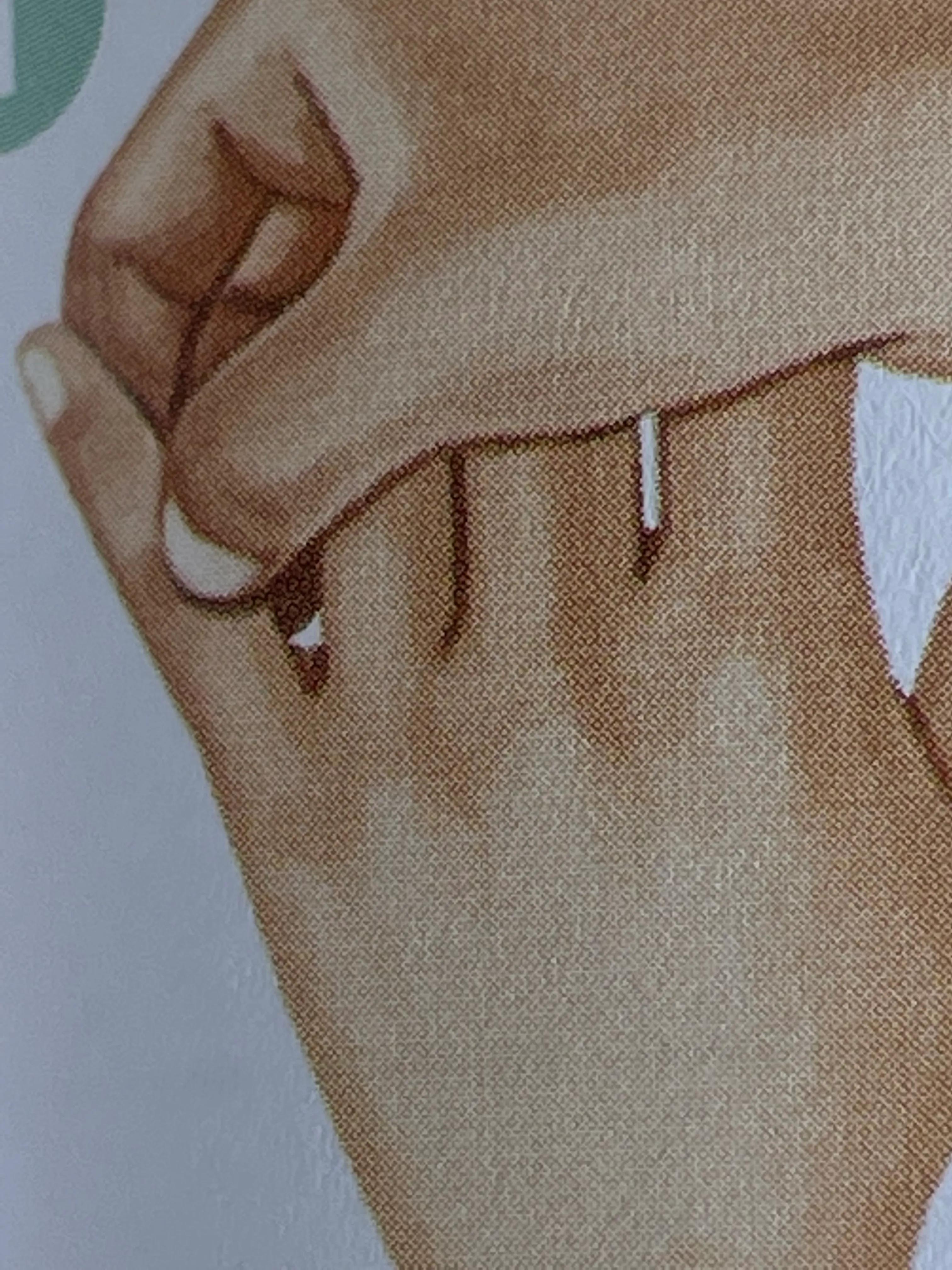 乳腺增生结节怎么办啊,乳腺增生结节怎么办呢