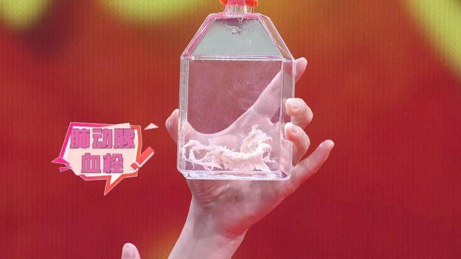 比腰肌劳损严重的是什么,比腰肌劳损还严重的是什么病