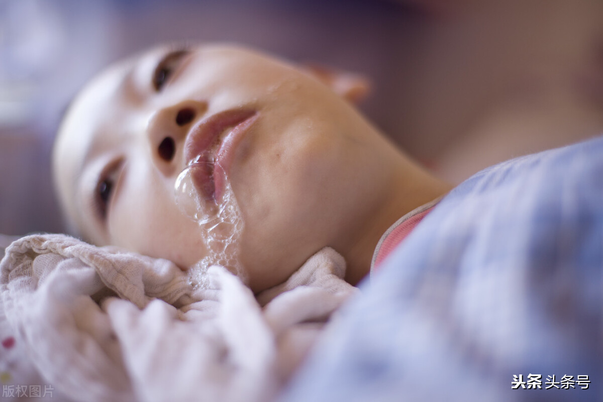 脑炎后遗症癫痫发作发热抽搐,小孩发高烧抽搐会不会是癫痫前期