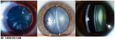 科普|“雾里看花”为哪般