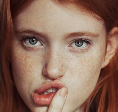 如何祛斑10种祛斑的简单最佳方法,祛斑方法教你如何祛斑最快最有效