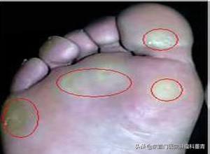 食管癌高风险人群做哪些检查,哪些类人群需要做癌症早期筛查