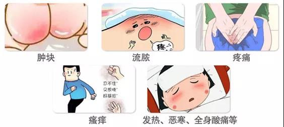 屁股后面有个小窟窿是肛瘘,屁股上长了个脓包有个窟窿